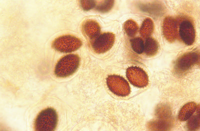 examen microscopique de contrôle des truffes